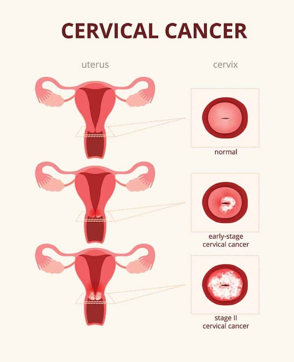 Pap Smear Test Doctor in Mayur Vihar, Delhi