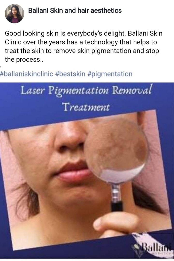 Skin Pigmentation Removal at Ballani Skin And Hair Aesthetics